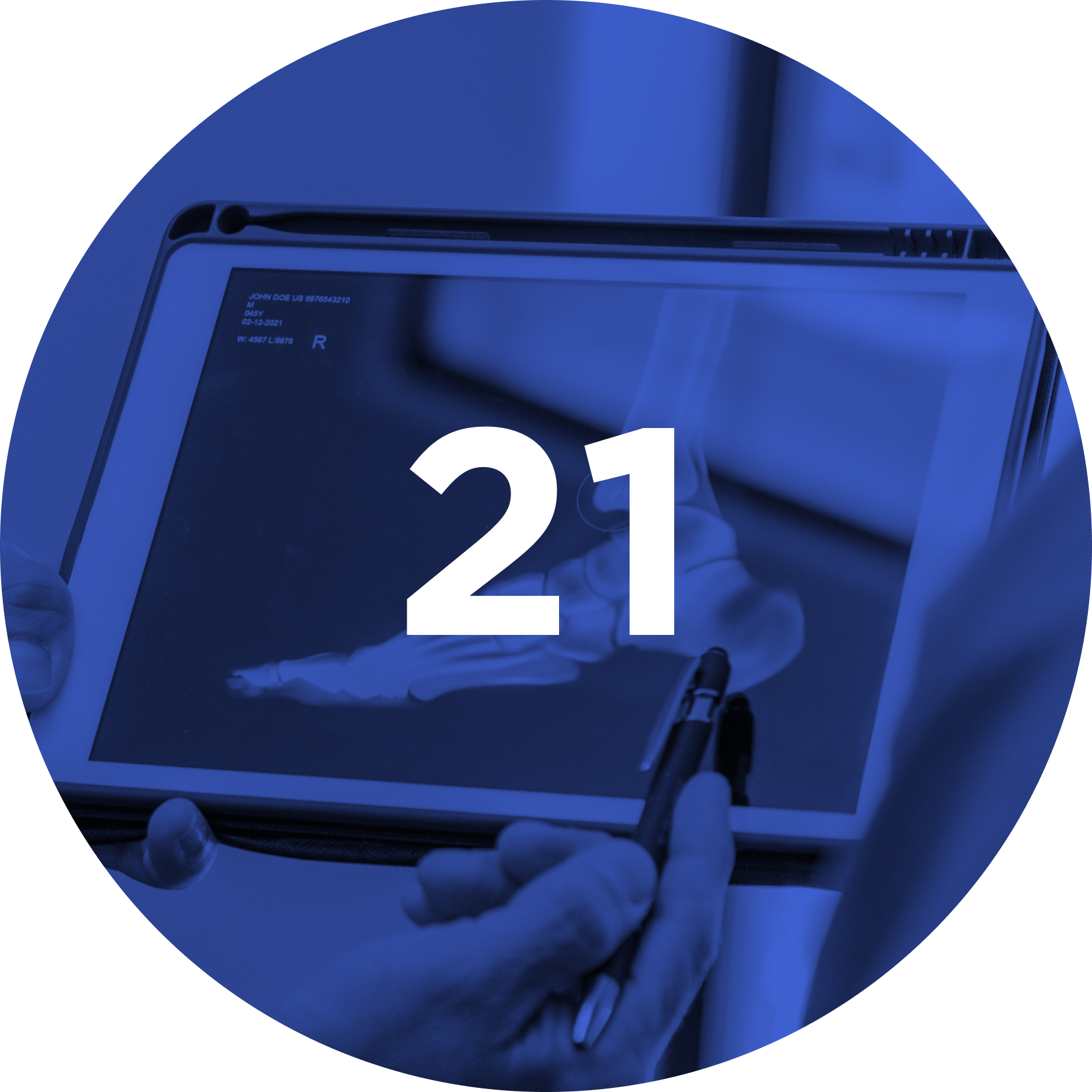 21